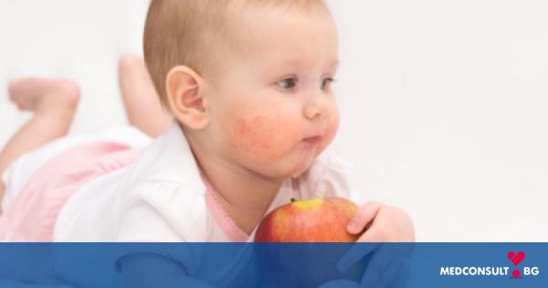 Хранителна алергия при деца