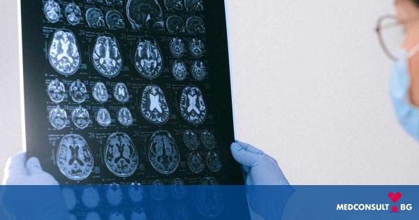Множествена склероза - как могат да се запазят когнитивните способности