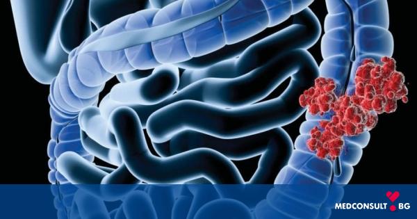Превенция и ранна диагностика на рак на дебелото черво