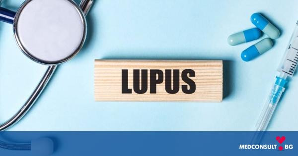 Лупус - причини, симптоми, лечение