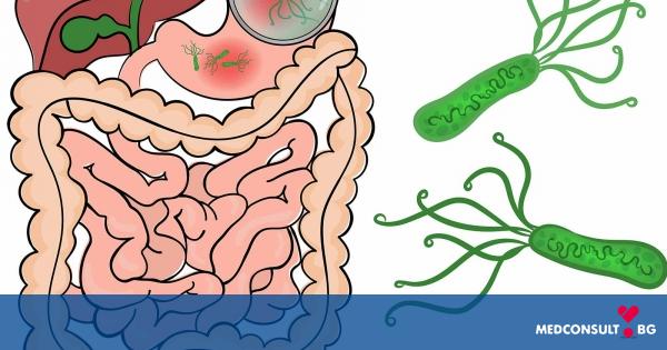 Инфекция с хеликобактер пилори - симптоми, причини, диагностика и лечение