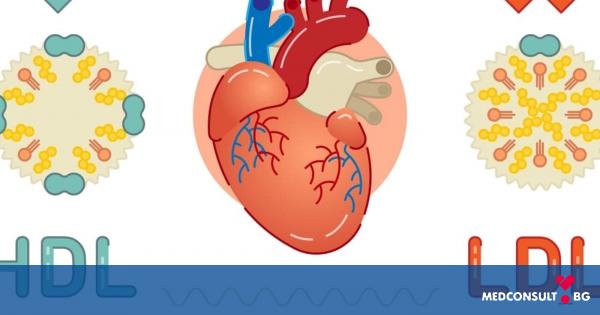 Високият холестерол е безшумен убиец - как да понижим стойностите
