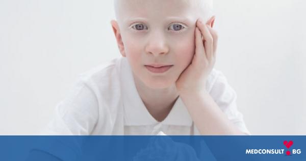 Албинизъм – същност, симптоматика и лечение